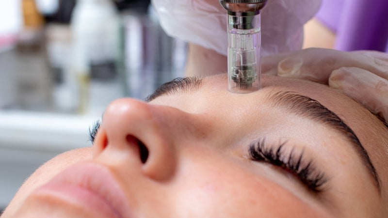 Microneedling Certification